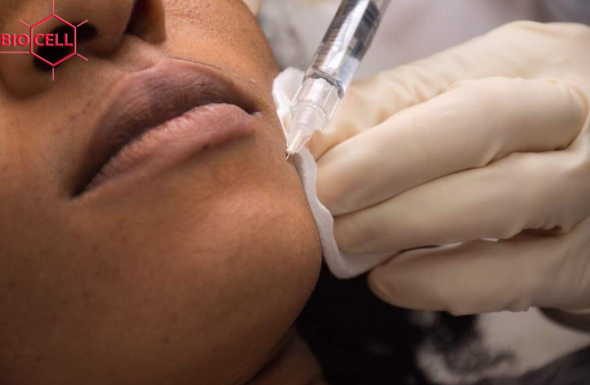 skin rejuvenation in Lagos skin rejuvenation in Lagos