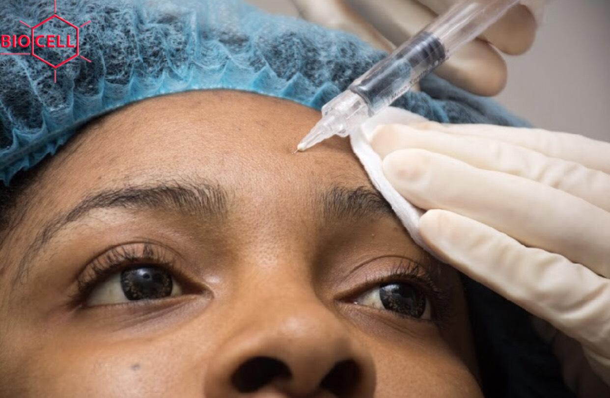 IMG_1092 skin rejuvenation