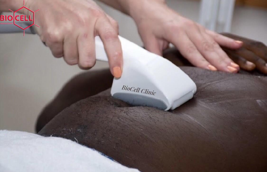 Flabby Saggy Skin Flabby Saggy Skin