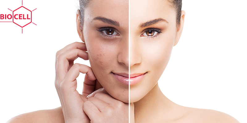 skin lightening treatments skin lightening treatments